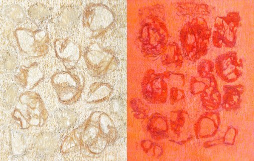 State of Mind II - 나_mixed 
media on canvas_91x72cm_2014(왼쪽)/State of Mind II - 너_mixed 
media on canvas_91x72cm_2014