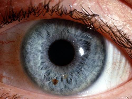 30대 노안 환자 급증. 사진=동아DB