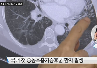 중동 호흡기증후군 메르스 환자 국내 첫 발생/YTN 캡처