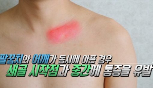 밤에 통증 심한 이유