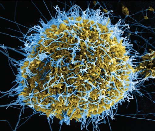 에볼라 재확산 시에라리온. 사진=에볼라 재확산 시에라리온/동아일보 DB