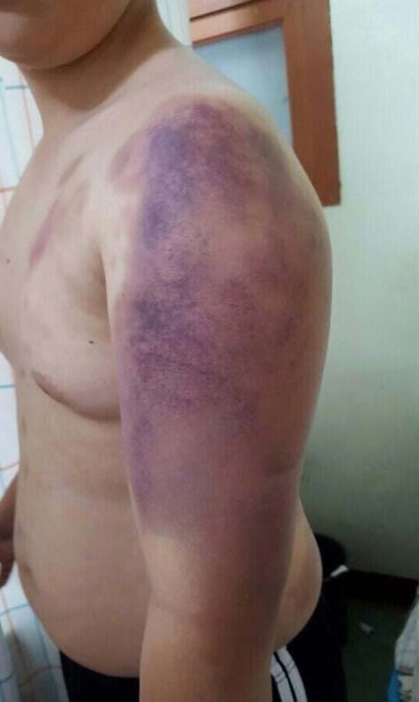 동급생 대학생 집단 폭행 (사진= 네이트 판 갈무리)