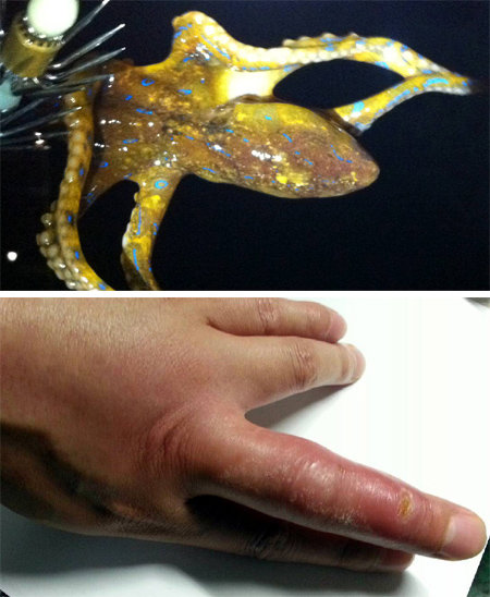 국립수산과학원 아열대수산연구센터는 10일 제주 협재해수욕장 인근에서 관광객 김모 씨(38)가 아열대성 맹독 문어인 
‘파란고리문어’(위쪽)에게 물려 신고한 사례가 발생했다고 29일 밝혔다. 오른쪽은 파란고리문어에게 물린 손의 모습. 국립수산과학원
 제공