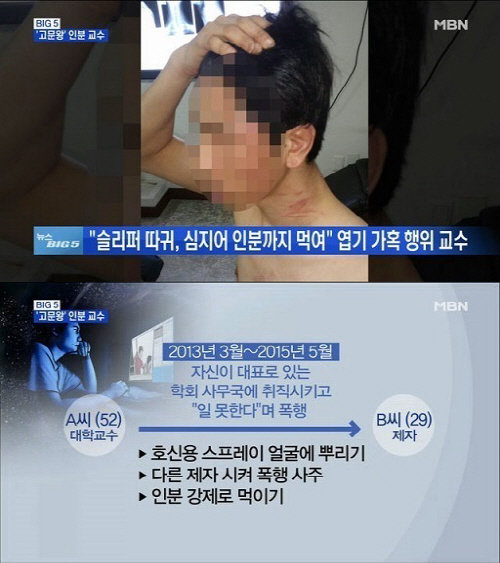 인분 교수 해명. 사진= MBN 방송 갈무리