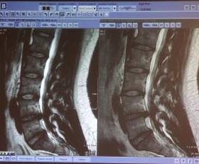 사진 박원순 시장 아들 박주신 씨 MRI사진. 동아DB
