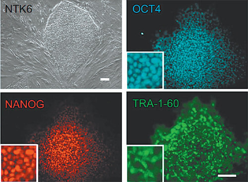 차의과학대 연구진은 체세포를 복제해 만든 배아줄기세포(왼쪽 위)에서 만능성을 확인할 수 있는 마커(OCT4,NANOg, TRA-1-60)들이 정상적으로 발현한다는 사실을 통해 모든 세포와 조직으로 분화할 수 있는 줄기세포라는 사실을 확인했다. 차병원그룹 제공