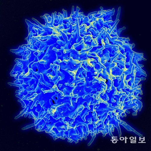 에이즈를 일으키는 HIV 바이러스의 모습. 동아일보DB