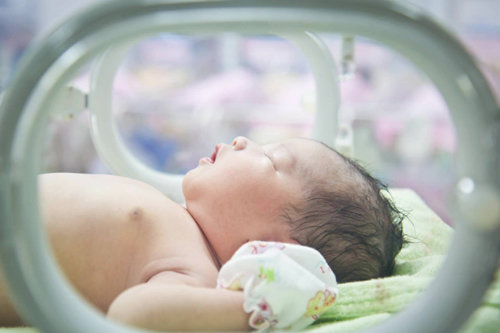 신생아집중치료실에 있는 이른둥이(미숙아). 이른둥이는 신체가 성숙되지 못한 채 태어나 출생 후 초기 2∼3년간 집중적인 관리가 필요하다. 최근 이른둥이 가정의 의료비 부담을 덜어줄 수 있는 정책에 대한 요구가 높아지고 있다. 대한신생아학회 제공