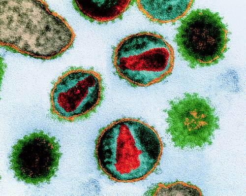 후천성면역결핍증(AIDS·에이즈)을 일으키는 바이러스. 동아DB