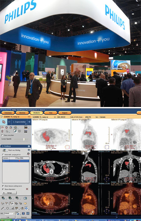 지난달 29일부터 이달 4일까지 미국 시카고에서 열린 북미영상의학회(RSNA) 현장. 이 행사에서 필립스는 종양의 위치와 크기 등을 정확하게 계산하는 MMTT 애플리케이션(아래 사진)을 소개해 주목받았다. 필립스 제공