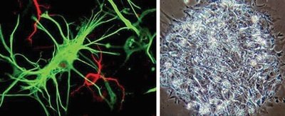 배아줄기세포가 신경세포(빨간색)와 이를 지지하는 별세포(초록색·옛 성상세포)로 분화한 모습(왼쪽)과 인간 배아줄기세포를 현미경으로 본 모습. 사진 제공 · 위스콘신대 메디슨캠퍼스