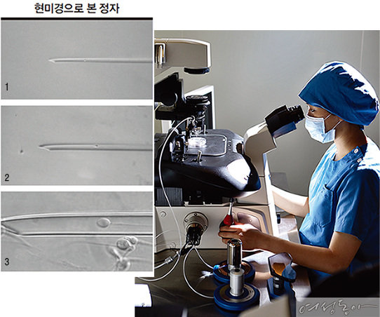 1_200배 확대 정자가 있다는 정도만 보임
2_400배 확대 대부분 난임 클리닉 사용
3_5880배로 확대 미세 바늘 내의 정상 형태 정자가 보임. 미래와 희망 산부인과에서는 국내 최초로 고배율 현미경을 도입했다.