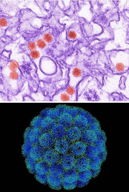 최근 국내에서 지카 바이러스(맨위쪽)에 감염된 환자가 처음 발생했다. 지카 바이러스는 신생아의 머리 둘레가 32cm가 되지 않는 소두증과의 연관성이 강하게 의심되고 있다. 아래 사진은 대유행을 일으키기에 유리한 조건을 두루 갖춘 대표적인 바이러스로 지목된 폴리오마 바이러스의 한 종류인 ‘SV40’이다. 위키피디아 제공