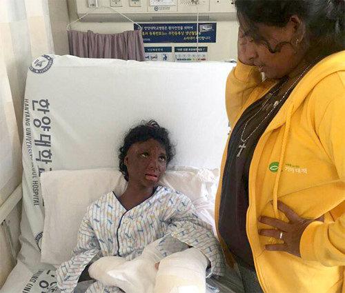스리랑카에서 온 화상 환자 로셸 양이 수술 직전 한양대병원 병실에 누워 있는 모습. 기아대책 제공