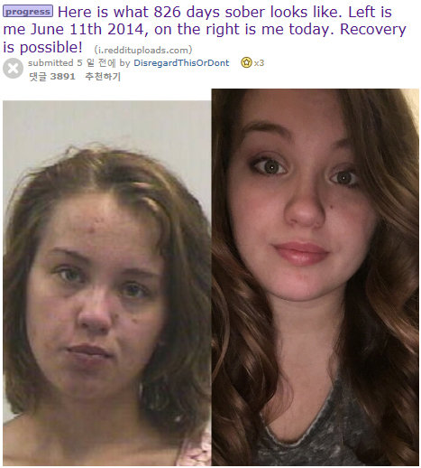 헤로인 중독 당시의 모습(왼쪽)과 헤로인을 끊은지 826일 이후의 모습. 사진=레딧 캡처