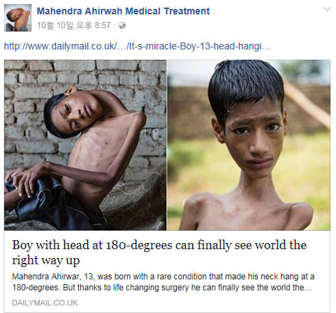 수술 전 마헨드라의 모습과 수술 후의 모습.사진=Mahendra Ahirwah Medical Treatment 페이스북 페이지 캡처