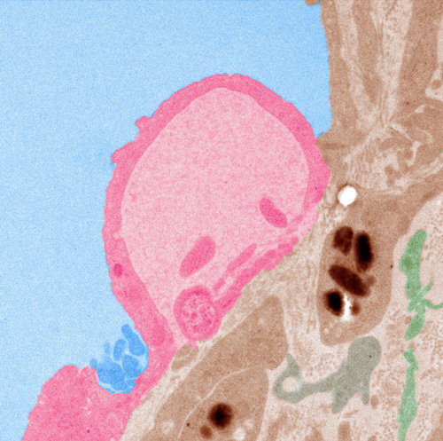 일반부 대상을 수상한 ‘외로운 핑크 돌고래’의 모습. 쥐의 망막 조직을 저며 6500배 확대한 뒤 색을 입힌 작품으로 김미정 기초과학연구원 혈관연구단 연구원이 출품했다. 세포 내 소기관의 형태가 얼굴을 찌푸린 돌고래를 닮았다. 김미정 연구원 제공