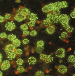 중증열성혈소판 감소증후군(SFTS) 바이러스