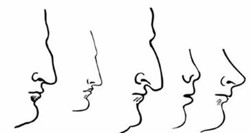 인류에게서 가장 널리 발견되는 코의 유형 5가지. 두개안면성형외과학회지 제공