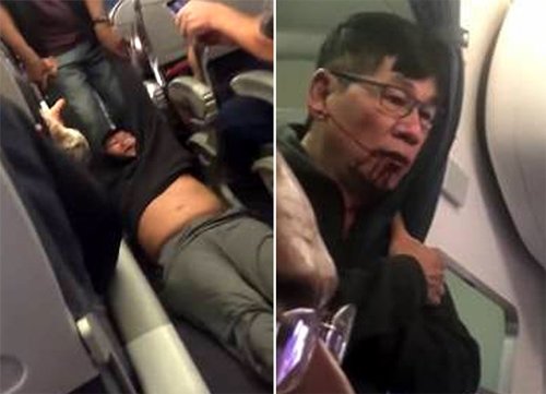 미국 유나이티드항공 여객기에 탑승했던 중국계 미국인 남성이 경찰관들에 의해 질질 끌려나오고 있다(왼쪽 사진). 이 과정에서 좌석 손잡이에 부딪힌 남성의 얼굴에서 피가 흐르고 있다. 유튜브 화면 캡처