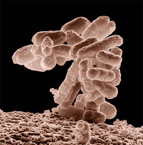 장내 미생물을 의미하는 ‘마이크로바이옴’의 현미경 이미지. 위키미디어 제공