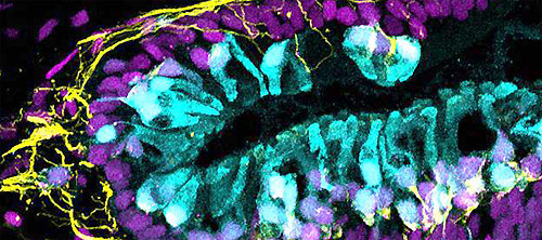 미국 인디애나대 연구진은 인간의 내이(內耳)를 오가노이드(실험용 초소형 인체기관) 형태로 만들어 발표했다. 푸른색은 청각세포, 노란색은 균형감각 신경, 보라색은 신경 연결에 관여하는 항체를 나타낸다. 칼 콜러 제공
