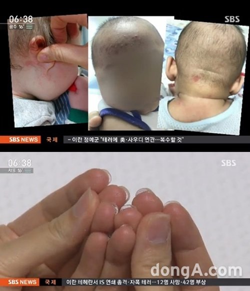 사진=SBS뉴스 화면 캡쳐