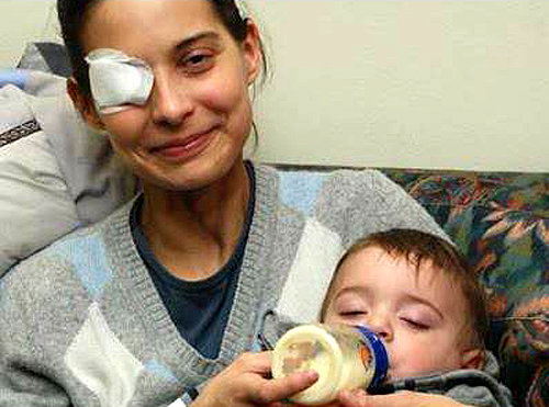 키아라 코르벨라의 생전 모습. 항암치료를 받지 못해 오른쪽 눈까지 잃었지만 살포시 머금은 미소엔 아이를 향한 사랑이 깊게 배어 있다. 구글 이미지