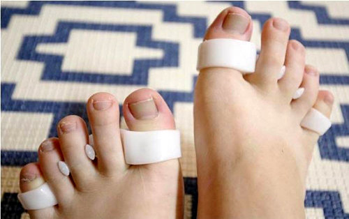 최근 젊은 여성 사이에서 인기를 끌고 있는 ‘발가락링’을 착용한 사진. 인터넷 쇼핑몰 캡처
