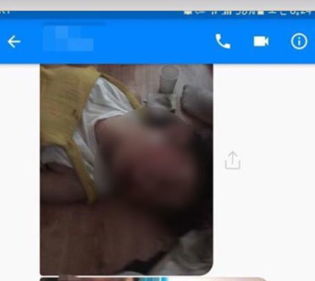 사진=강릉 폭행 사건 피해자/페이스북