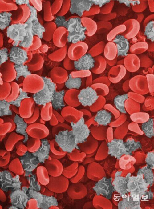 전자현미경으로 촬영한 혈액 속 적혈구와 백혈구. RH-형은 표면에 RH응집원이 없는 적혈구를 갖고 있는 혈액형을 말한다. 사진 동아일보DB