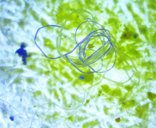 미세섬유를 현미경으로 확대해 보면 기다란 실처럼 보인다. ⓒM.Danny25(wikimedia)