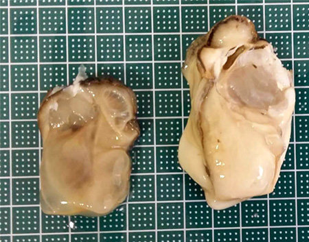 3배체 굴(오른쪽)은 생식 능력을 제거해 일반 굴보다 더 크고 통통하게 자란다. 국립수산과학원 제공
