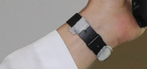 테이프 붙인 손목시계 이 교수는 수술에 방해될까봐 손목시계 밴드와 버클 부분을 의료용 테이프로 감아놓았다.