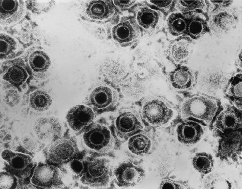바이러스는 유전자 치료에서 치료 유전자를 세포나 체내에 전달하는 핵심적인 역할을 한다. 헤르페스(사진)나 렌티, 아데노 바이러스처럼 사람 세포에 잘 침투하는 바이러스를 이용한다. 사진 출처 미국 질병통제예방센터