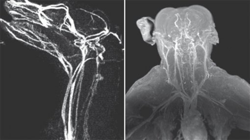 산화철 나노입자 조영제(나노램프)를 이용해 개(왼쪽 사진)와 원숭이의 혈관을 자기공명영상(MRI)으로 촬영한 모습. 미세한 뇌 혈류까지 선명하게 볼 수 있어 뇌중풍 등 뇌질환 진단에 활용할 수 있다. 사진 출처 기초과학연구원
