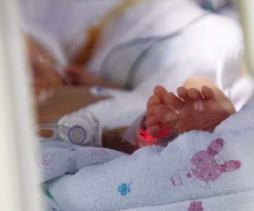 서울대 어린이병원 NICU에 입원해 있는 신생아 환자. 조영철 기자