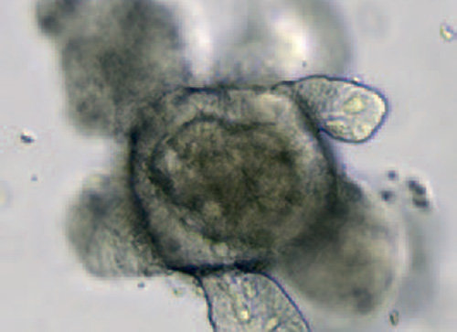 줄기세포에서 자란 장 조직 오가노이드의 실제 모습. 플로스원 제공