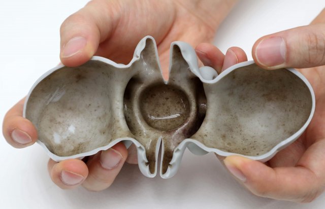 아이의 ‘목욕 친구’인 고무오리는 겉과 속이 다른 녀석이었다. 네 살배기가 3년간 써온 고무오리를 4일 열어보니 안은 곰팡이와 물때로 가득했다. 최근 해외 연구팀은 물놀이 장난감 1개당 세균이 13억 마리씩 검출됐다고 발표했다.  양회성 기자 yohan@donga.com