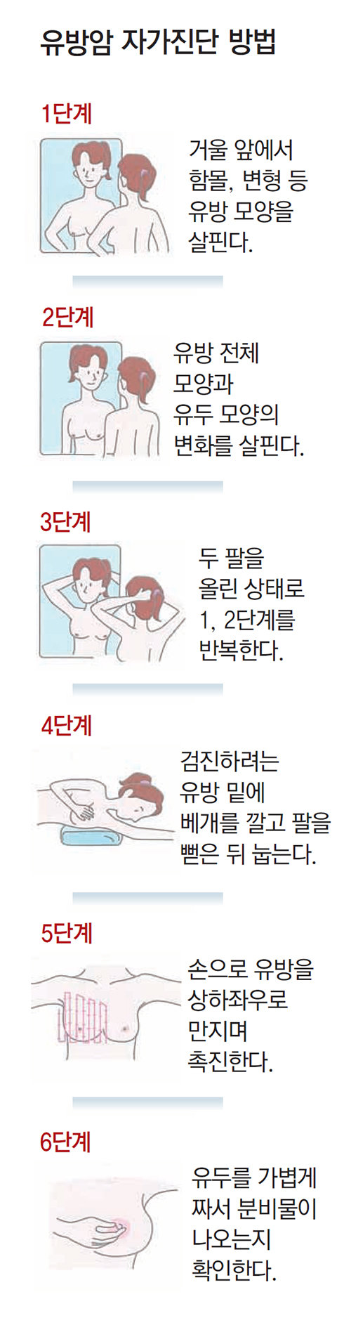 여성 상징' 제거 않고 암세포만 잡아내… 상실감까지 치료｜동아일보