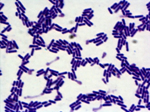 미세먼지에 대한 알르레기 반응을 감소시킬 수 있다는 프로바이오틱스 유산균 ‘락토바실러스 카제이 HY2782’. 한국야쿠르트 제공