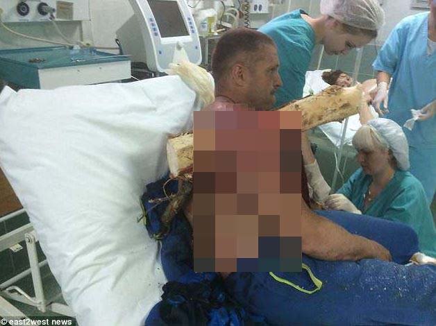 사진=데일리메일