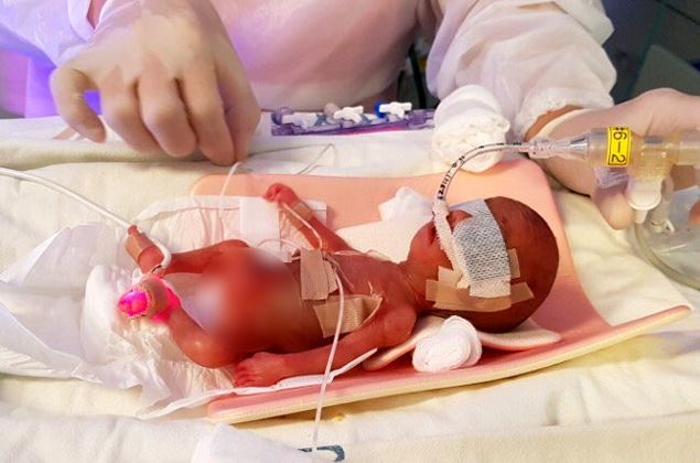 사진=서울아산병원