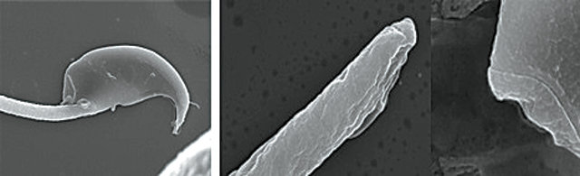‘SPATC1L’ 단백질이 발현되지 않도록 만든 생쥐의 정자(오른쪽). 정상 생쥐의 정자(왼쪽)와 달리 머리와 꼬리 부분이 분리돼 있다. 광주과학기술원 제공