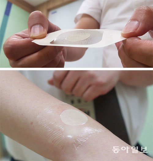 한국기계연구원이 인체에 무해한 천연 DNA 단백질을 사용해 개발한 ‘나노·마이크로 DNA 니들패치’(위 사진). 피부에 닿는 
아랫면에 털처럼 가는 미세돌기가 솟아 있다. 아래 사진은 니들패치를 붙인 모습. 대전=송경은 동아사이언스 기자 
kyungeun@donga.com
