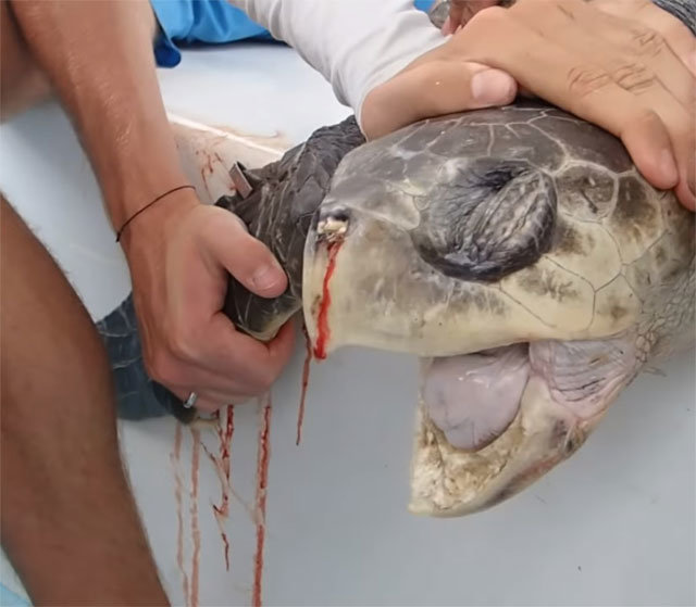 코스타리카 해안에서 구조된 바다거북의 한쪽 코에 플라스틱 빨대가 박혀 있다가 제거돼 피가 줄줄 흐르고 있다. 2015년 일어난 일이지만 올해 유튜브를 통해 공개돼 충격을 주었다. 유튜브 화면 캡처