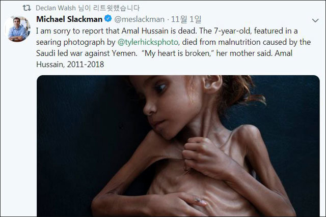 마이클 슬랙먼 뉴욕타임스 국제 에디터는 1일 트위터에 “사진에 나온 7세 소녀 아말 후사인은 사우디아라비아가 이끈 예멘 내전으로 
인해 영양실조로 죽었다. 이 소식을 전하게 되어 유감”이라고 적었다. 후사인의 어머니는 “가슴이 찢어진다”고 말했다고 전했다. 
마이클 슬랙먼 트위터
