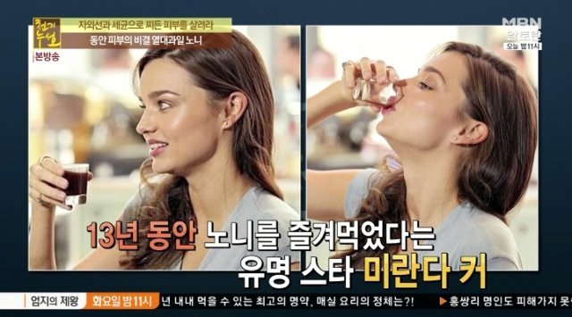 사진=MBN ‘천기누설’ 방송 캡처