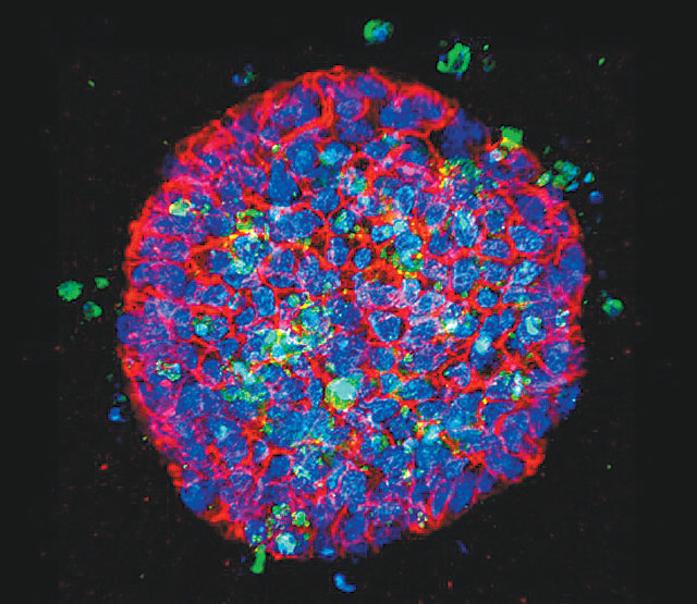 올림푸스가 개발한 공초점 레이저 생물현미경을 이용해 대장암 조직을 찍은 사진이다. 세포마다 각각 농도를 달리해 약을 주입한 다음 세포의 반응을 색으로 구분해 찍었다. 파란색은 살아있는 세포, 초록색은 죽은 세포다. 올림푸스 제공