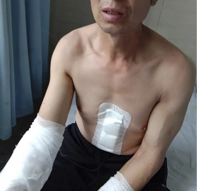 온몸에 상처를 입은 샤오페이 아버지 - 허베이 경찰 보도자료